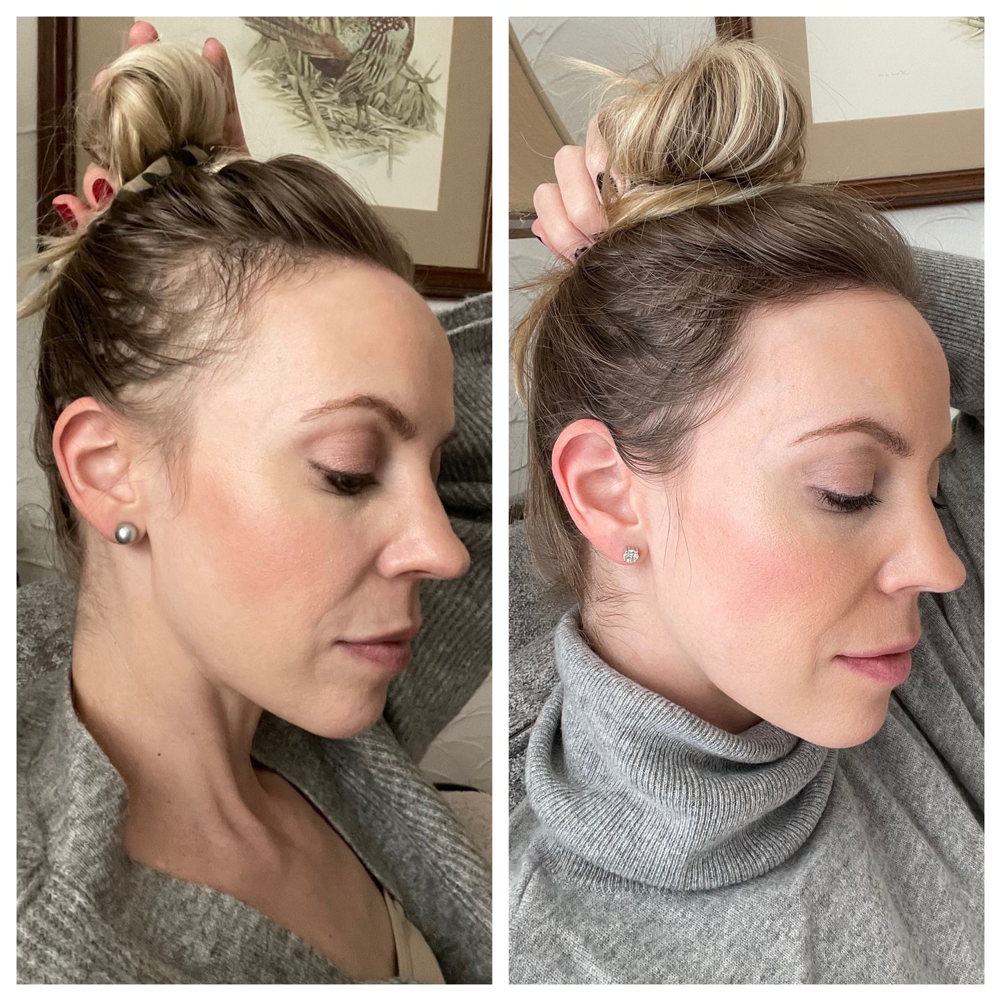 Benvu Advanced Hair Growth Roll-On Serum