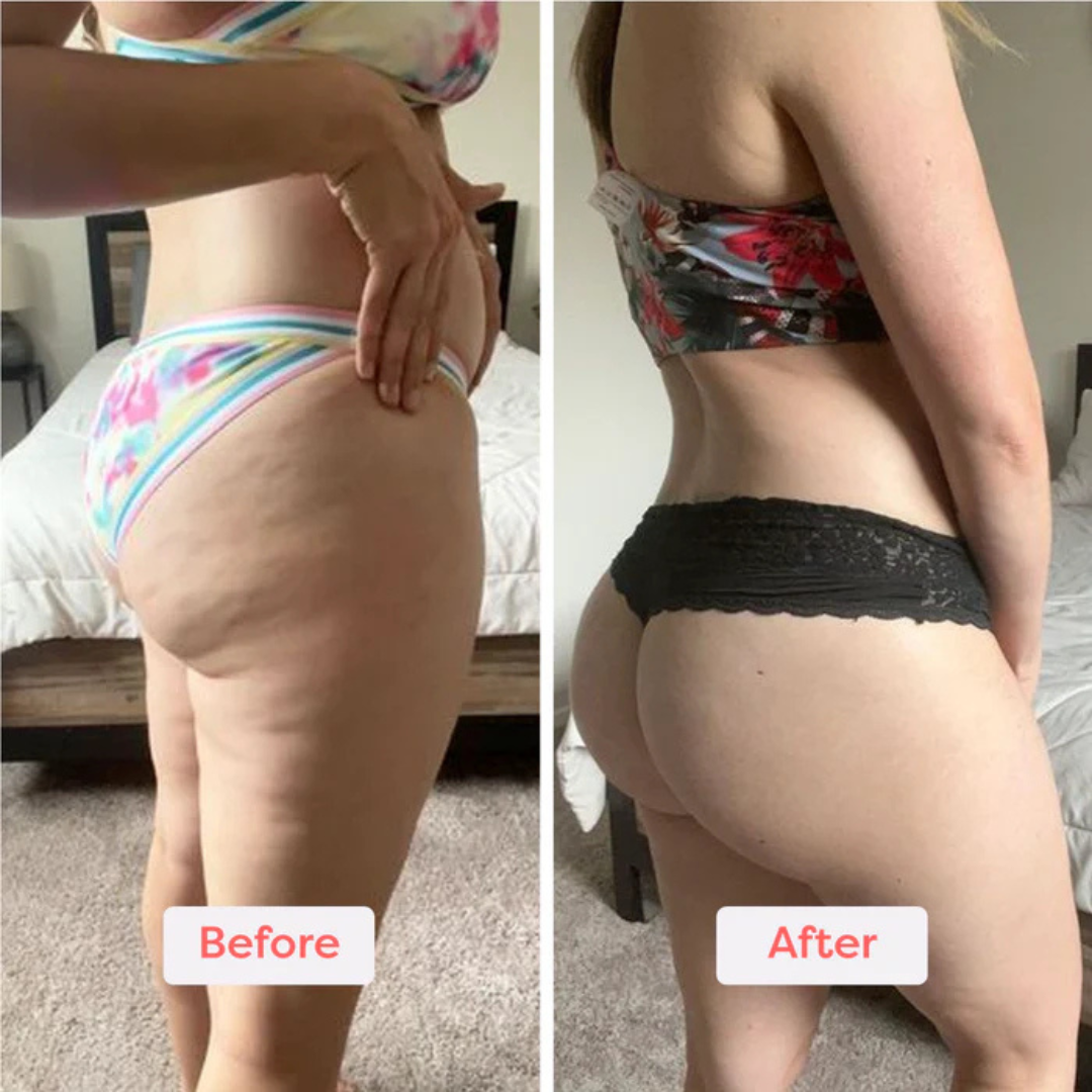 SmoothRoll 360 – Lymphatic Massage & Body Roller