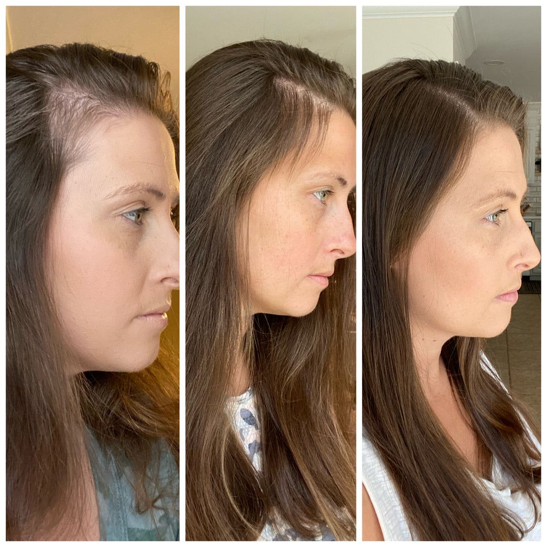 Benvu Advanced Hair Growth Roll-On Serum