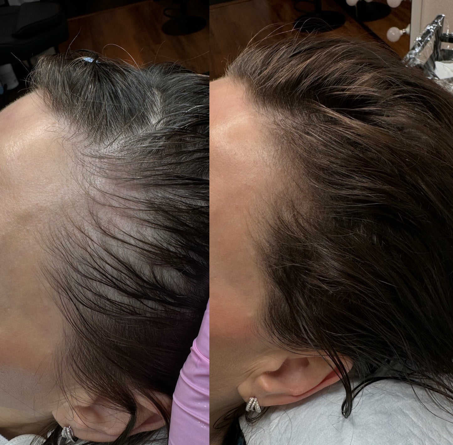 Benvu Advanced Hair Growth Roll-On Serum