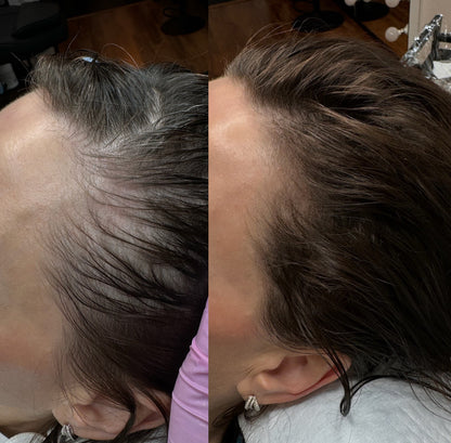 Benvu Advanced Hair Growth Roll-On Serum