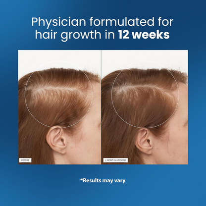 Eviare Advanced Hair Growth Roll-On Serum