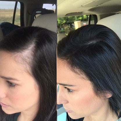 Eviare Advanced Hair Growth Roll-On Serum